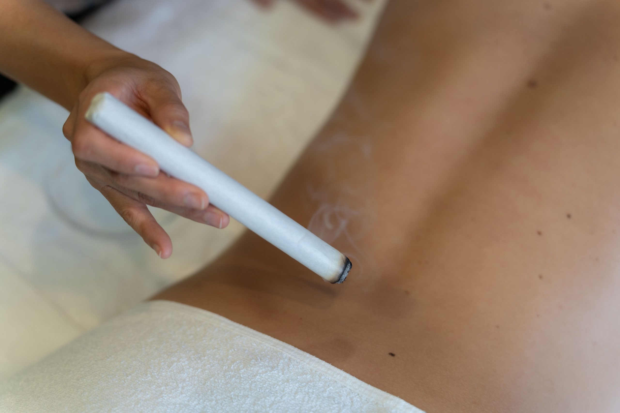 MOXIBUSTION